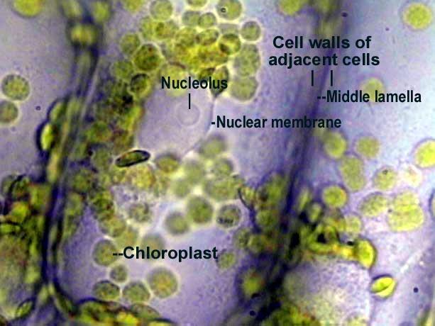 Anacharis (Elodea) leaf cells